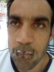 روزجمعه۱۳ اوت پلیس یونان به محل تحصن پناهجویان ایرانی در مقابل مقر سازمان ملل یورش برد